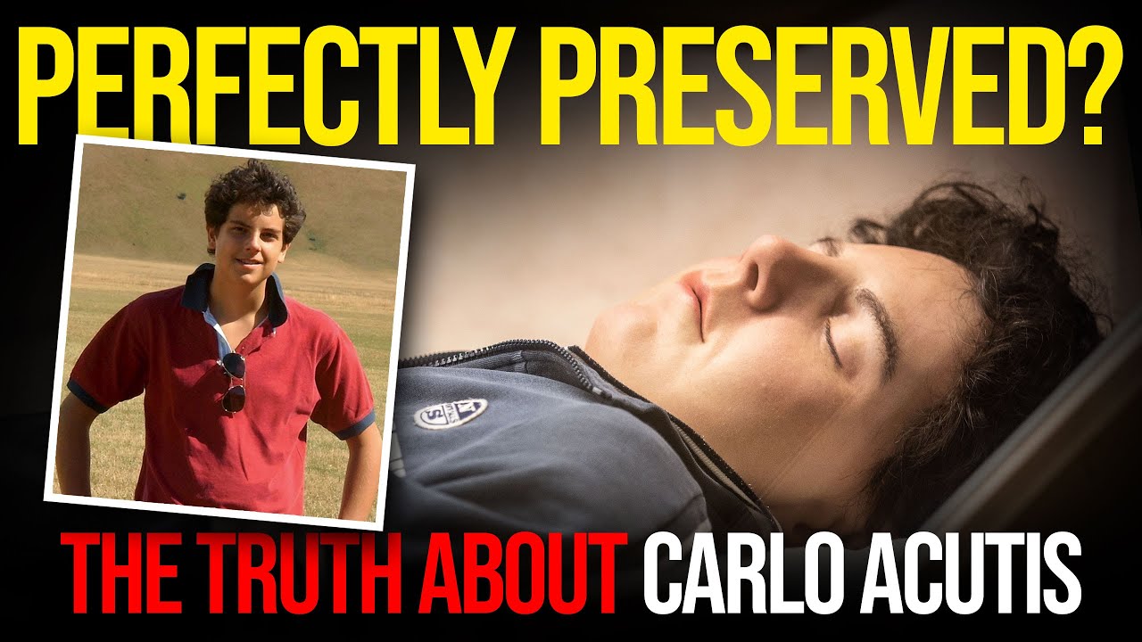 carlo acutis how is body preserved