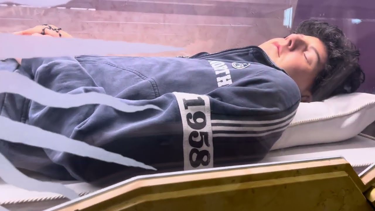how is carlo acutis body preserved