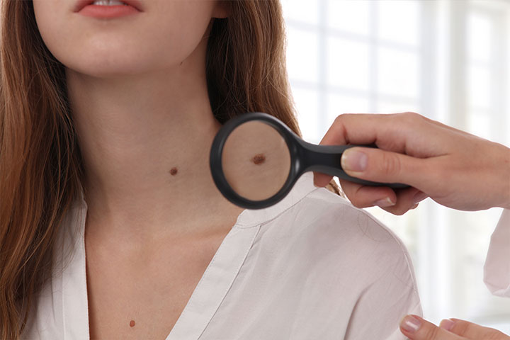 Étiquettes de peau