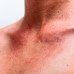 Changements de peau pendant la grossesse 9 Changements de peau pendant la grossesse 1572316024 916 Embarazo Cambios en la piel