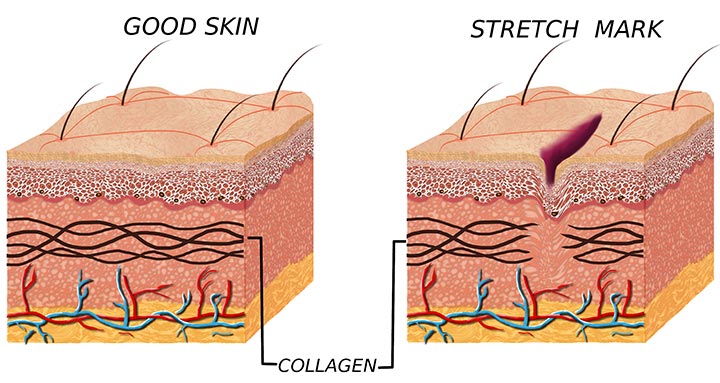 La biologie de base de la peau.