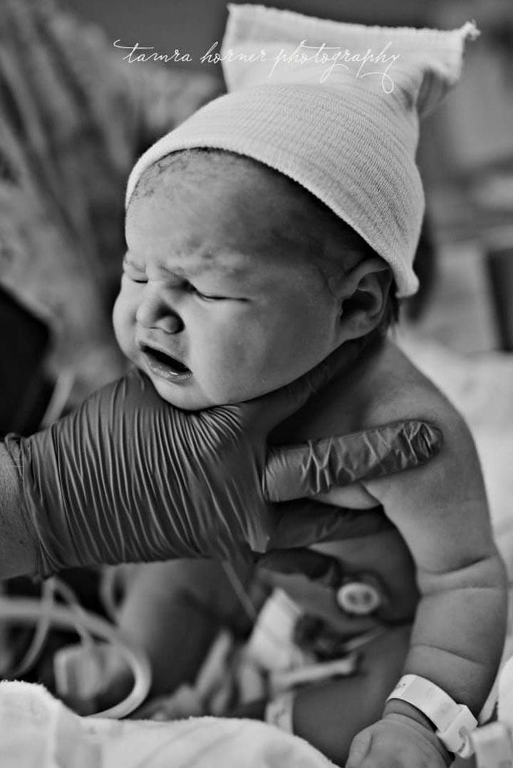 Docteur, projection, bébé