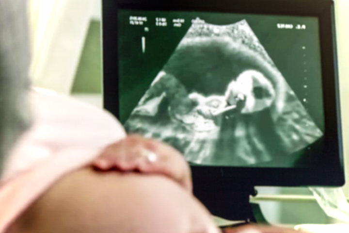 Rupture du placenta