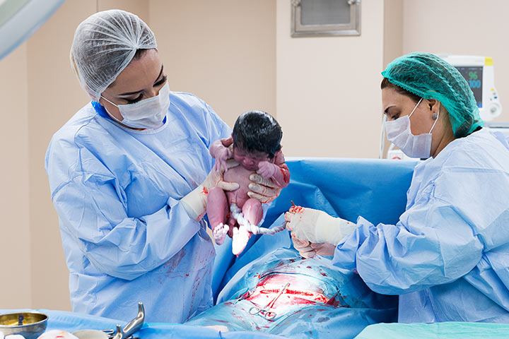 Faits sur le cordon nuchal