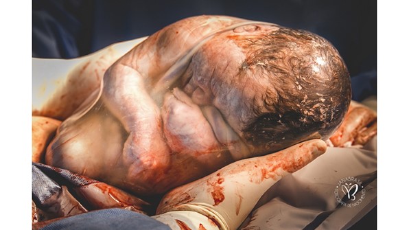 bébé dans un sac amniotique