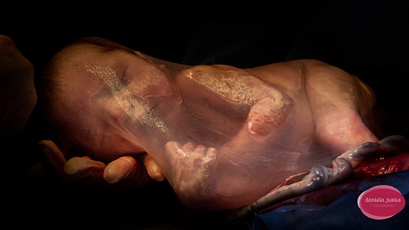 bébé dans un sac amniotique