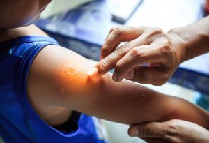 Répulsifs anti-moustiques sûrs et dangereux pour les bébés 16 Répulsifs anti-moustiques sûrs et dangereux pour les bébés 1588982049 107 Repelentes de mosquitos seguros e inseguros para bebes