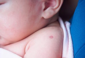 Vacciner votre nouveau-né: vaccination dans les 24 premières heures 1588983621 209 Vacunando a su recien nacido vacunacion en las primeras 24