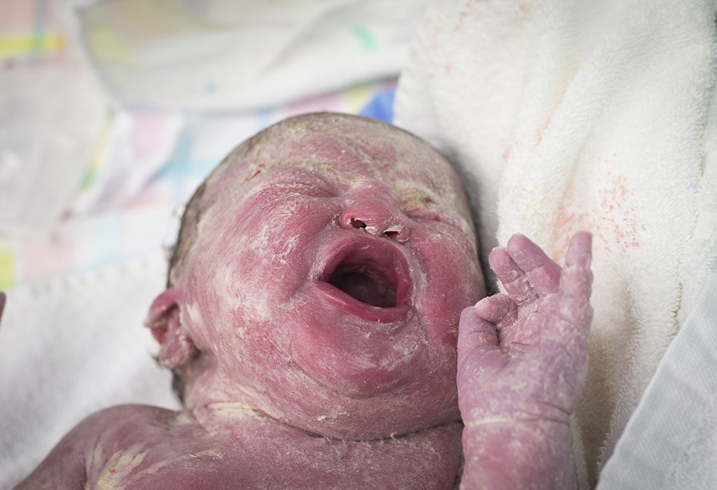 Est-il sûr d'utiliser la lotion pour bébé chez les nouveau-nés? 9 Nouveau-né recouvert de vernix "width =" 1024 "height =" 700 "srcset =" https://cdn.cdnparenting.com/articles/2018/08/96088421-H.jpg 1024w, https: //cdn.cdnparenting. com /articles/2018/08/96088421-H-768x525.jpg 768w, https://cdn.cdnparenting.com/articles/2018/08/96088421-H-218x150.jpg 218w, https: //cdn.cdnparenting. com /articles/2018/08/96088421-H-696x476.jpg 696w, https://cdn.cdnparenting.com/articles/2018/08/96088421-H-614x420.jpg 614w "tailles =" (largeur maximale: 1024px ) 100vw, 1024px