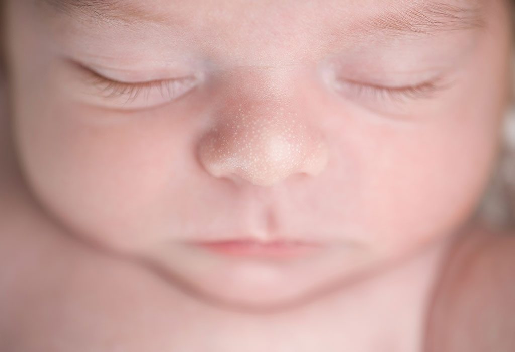 Éruption Cutanée Visage Bébé Éruption cutanée de bébé fautil s — free download
