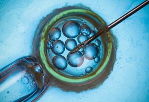Fécondation in vitro (FIV) pour le traitement de l'infertilité 1589127122 816 Fertilizacion in vitro FIV para el tratamiento de infertilidad