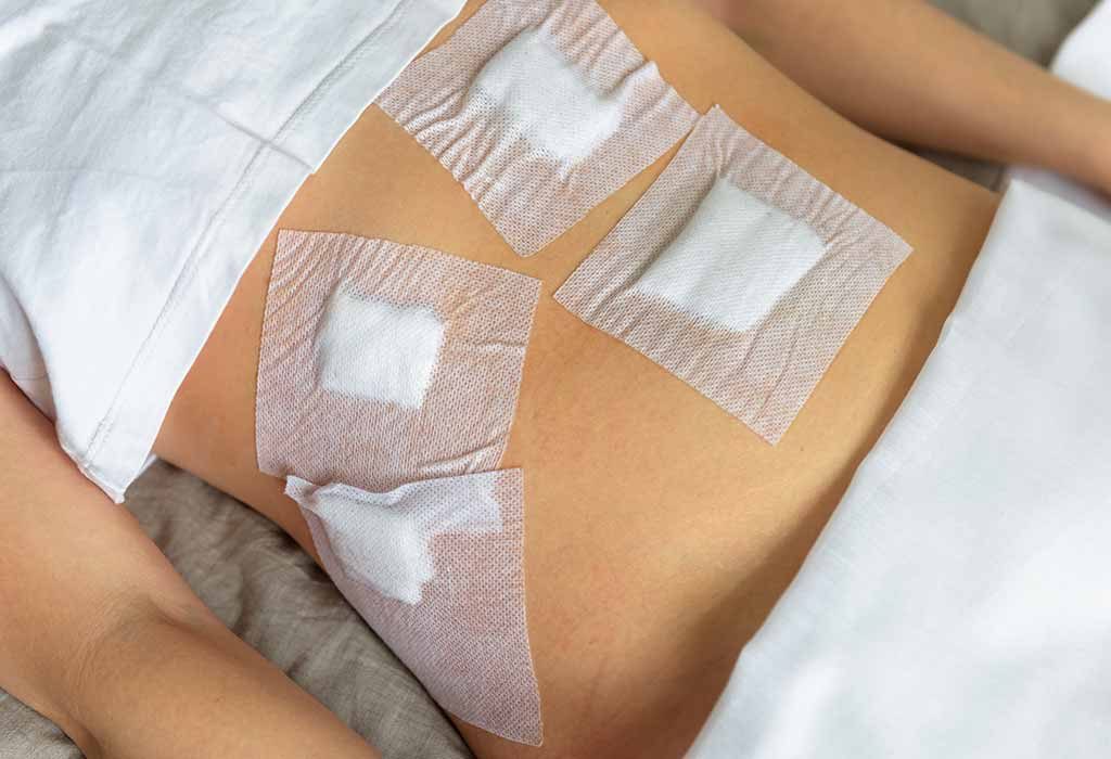 Infertilité féminine: causes, signes et remèdes maison 31 Laparoscopie "width =" 1024 "height =" 700 "srcset =" https://cdn.cdnparenting.com/articles/2018/01/22120121/1039084834-H.jpg 1024w, https://cdn.cdnparenting.com/ articles / 2018/01/22120121/1039084834-H-768x525.jpg 768w, https://cdn.cdnparenting.com/articles/2018/01/22120121/1039084834-H-218x150.jpg 218w, https: // cdn. cdnparenting.com/articles/2018/01/22120121/1039084834-H-696x476.jpg 696w, https://cdn.cdnparenting.com/articles/2018/01/22120121/1039084834-H-614x420.jpg 614w "tailles = "(largeur maximale: 1024px) 100vw, 1024px