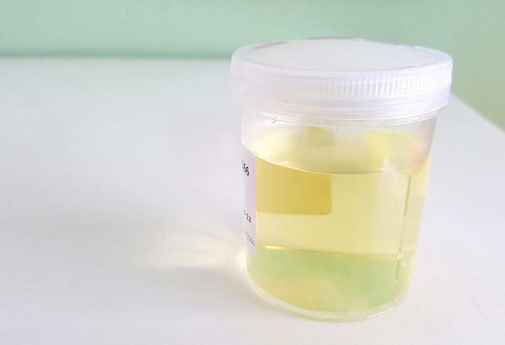 Test de grossesse à domicile avec dentifrice: méthode et efficacité 6 Échantillon d
