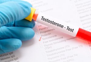 Test de testostérone "width =" 1647 "height =" 1131 "srcset =" https://dinerados.com/wp-content/uploads/2020/05/1589412205_995_Pruebas-de-fertilidad-masculina-como-Verificar-la-fertilidad -masculina.jpg 300w, https://cdn.cdnparenting.com /articles/2017/12/482121262-H-100x70.jpg 100w, https://cdn.cdnparenting.com/articles/2017/12/482121262-H -218x150.jpg 218w, https://cdn.cdnparenting.com /articles/2017/12/482121262-H-436x300.jpg 436w "tailles =" (largeur maximale: 1647px) 100vw, 1647px