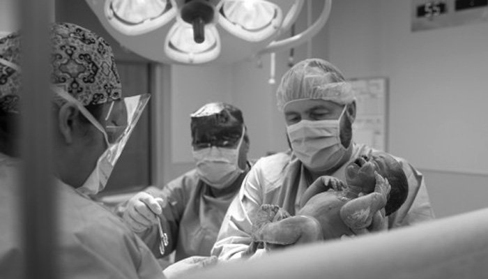 3 vérités sur les mamans césariennes 3 3 vérités sur les mamans césariennes