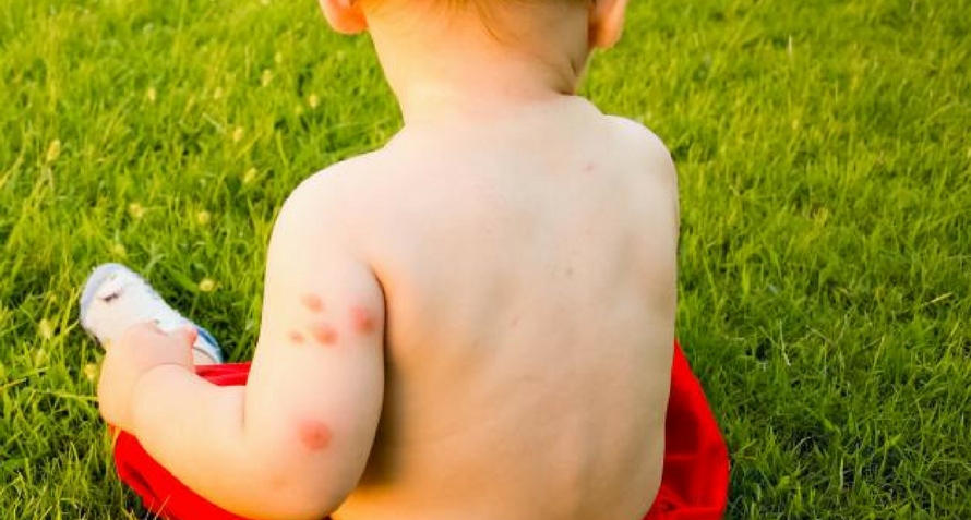 5 façons dont les maladies transmises par les moustiques pourraient nuire au développement global de votre enfant 6 8 façons dont les maladies transmises par les moustiques pourraient nuire au développement global de votre enfant