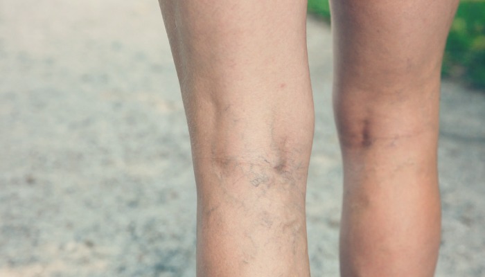 5 surprises de grossesse bizarres