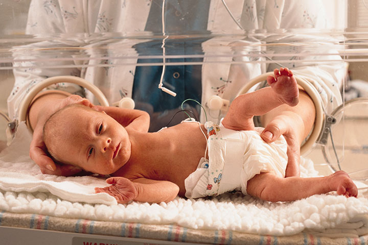 6 causes et 5 traitements contre l'épilepsie chez les bébés 9 L'épilepsie chez les bébés