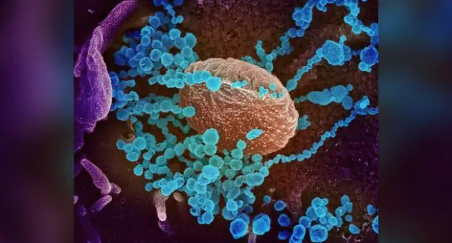 Coronavirus