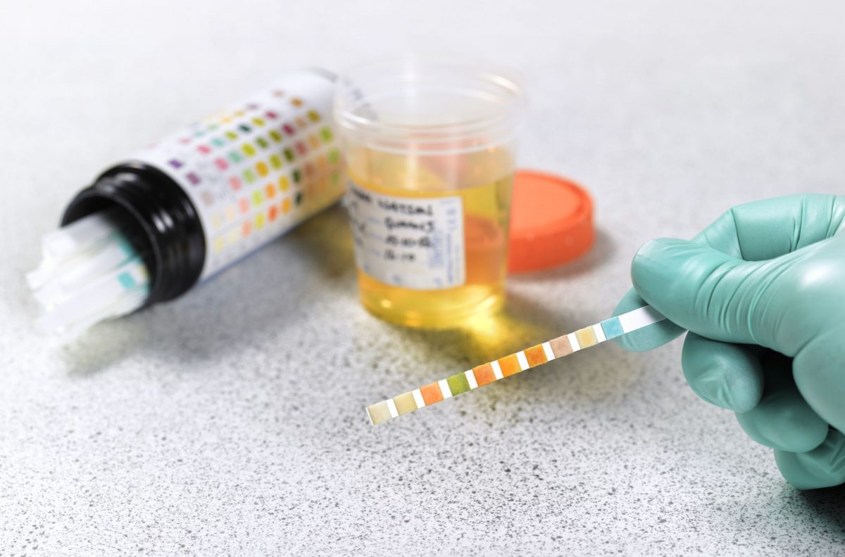 Combien de temps les médicaments peuvent-ils être détectés dans votre système 7 Combien de temps les médicaments peuvent-ils être détectés dans votre système