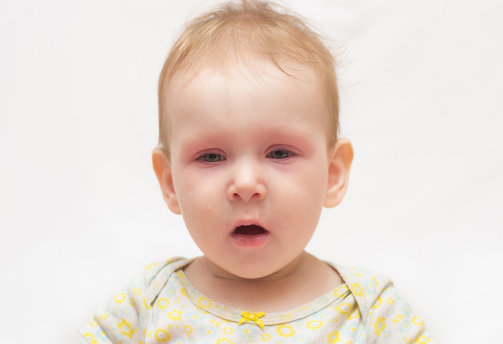 Un bébé malade aux yeux rouges
