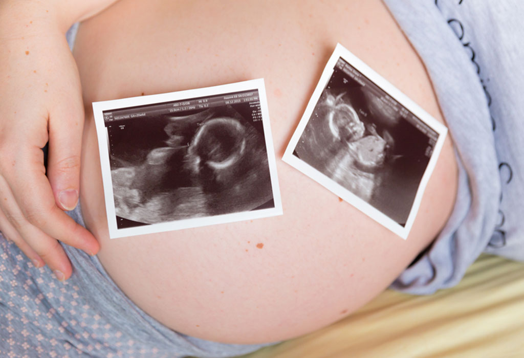 Comment tomber enceinte avec des jumeaux