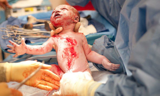 Merde, c'est un bébé laid