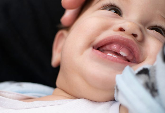 Dents tordues chez les bébés