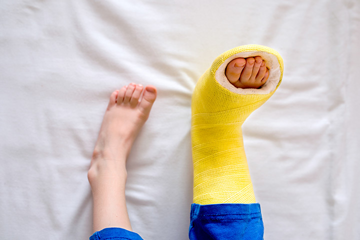 Causes, symptômes et traitement de la maladie osseuse fragile