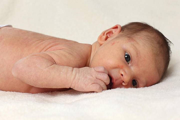 éruption de chaleur chez les bébés