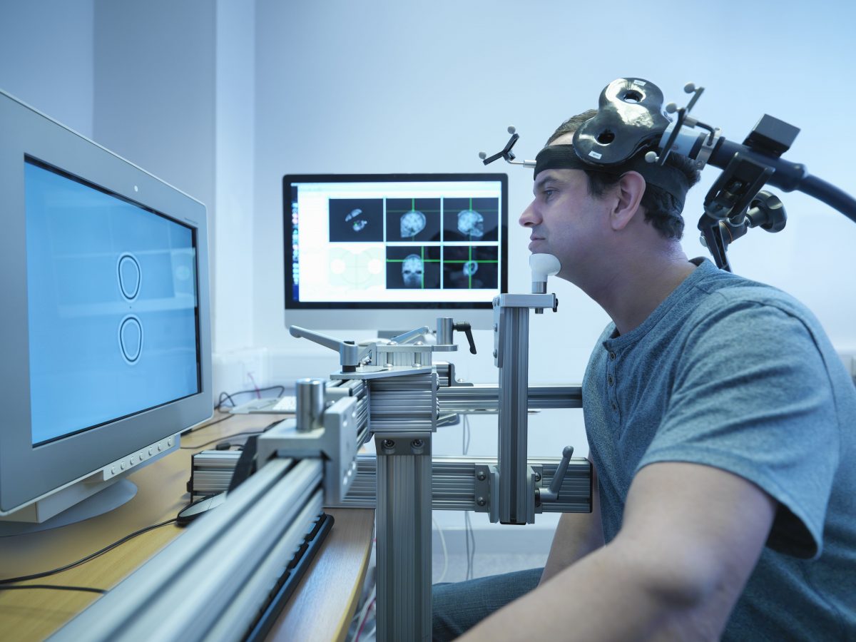 Stimulation magnétique transcrânienne pour le traitement des TOC