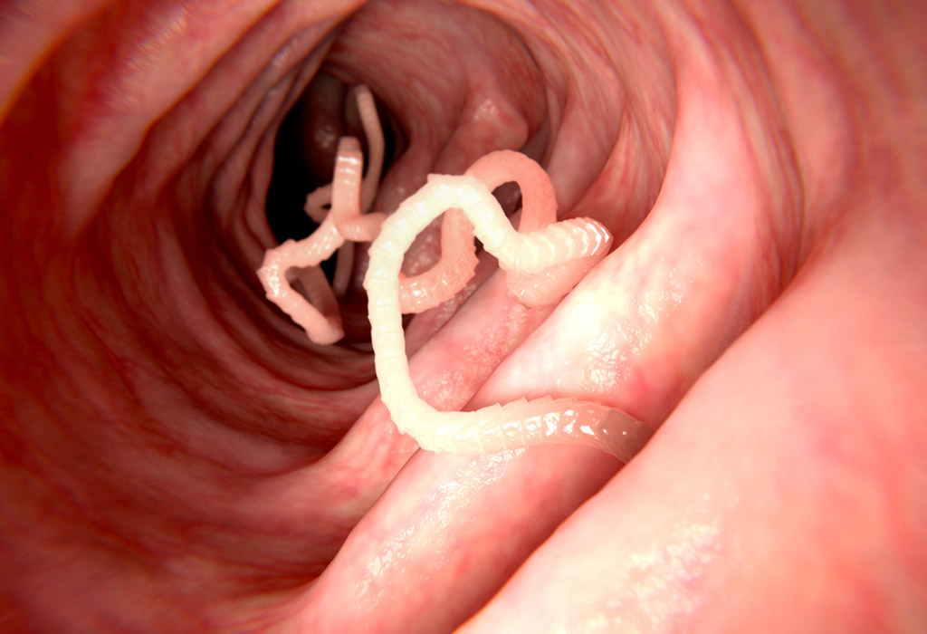 Infection par les vers chez les bébés - causes, symptômes et traitement