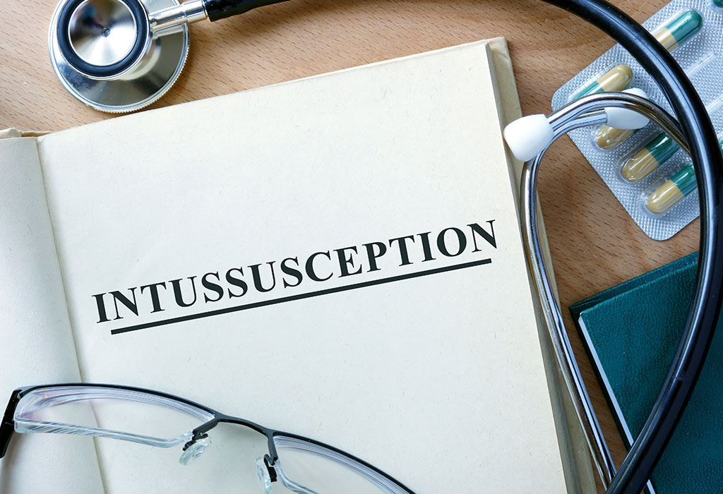 Intussusception chez les nourrissons - Signes, causes et traitement 3 Intussusception chez les nourrissons