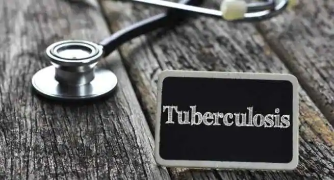 Tuberculose