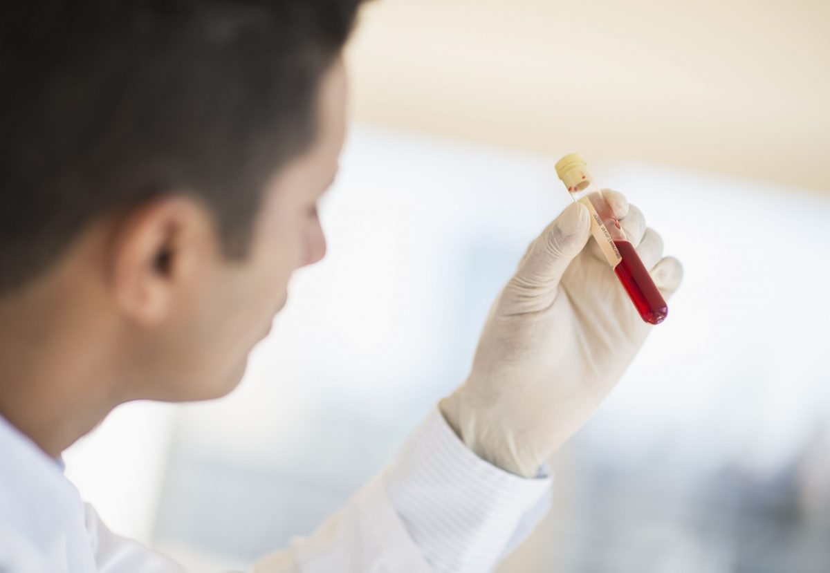 La dépression peut-elle être détectée avec un test sanguin? 2 La dépression peut-elle être détectée avec un test sanguin?