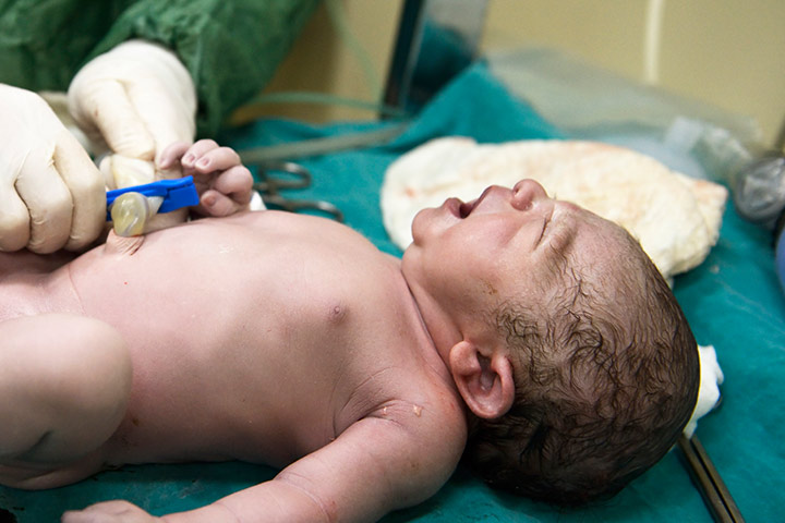 Le cordon retardé a des effets positifs sur votre bébé. Voilà comment