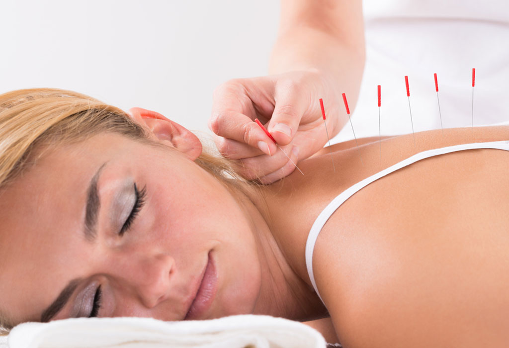 Traitement d'acupuncture
