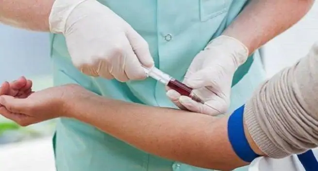 Les anticorps des patients récupérés offrent un nouvel espoir dans le traitement au COVID-19