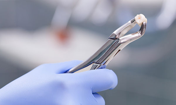 Les dents d'une troisième niveleuse tirées à l'école sans la permission de maman 7 Les dents d'une troisième niveleuse tirées à l'école sans la permission de maman