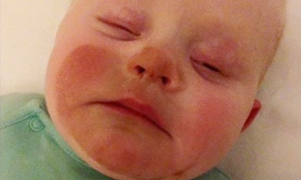 Maman donne accidentellement un faux bronzage à son bébé pendant l'allaitement