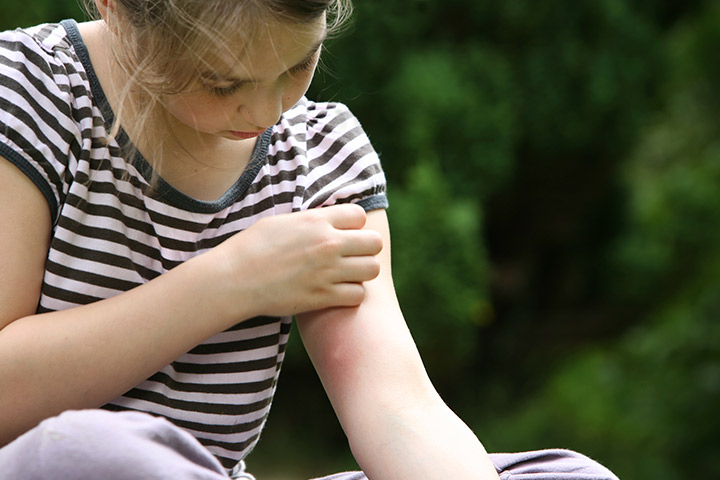 Piqûres de tiques chez les enfants: comment y faire face 10 Piqûres de tiques chez les enfants