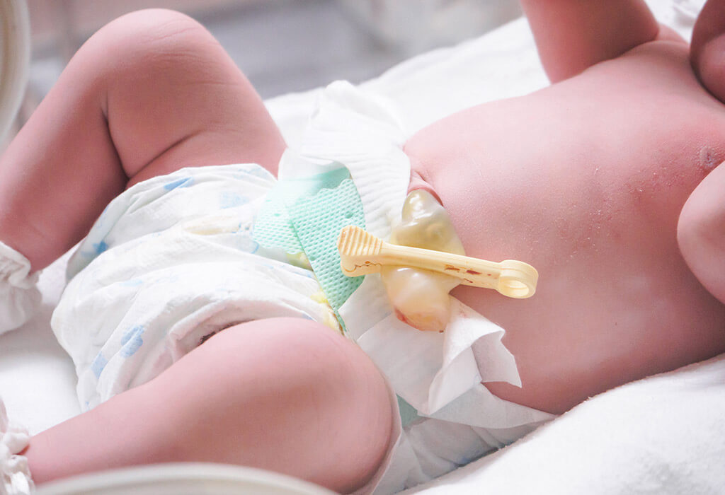 Prendre soin du cordon ombilical du nouveau-né: tout ce que les parents doivent savoir 8 Prendre soin du cordon ombilical du nouveau-né: tout ce que les parents doivent savoir