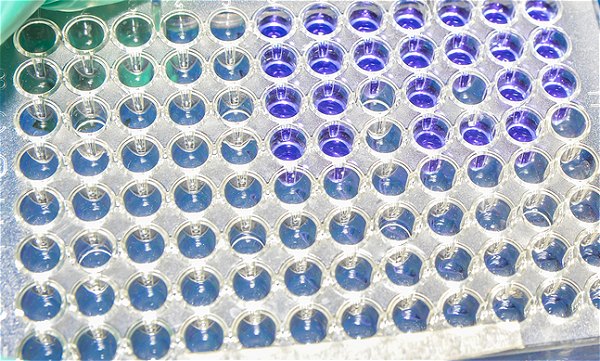 Tests génétiques pour les antidépresseurs et les psychotropes: pas encore là