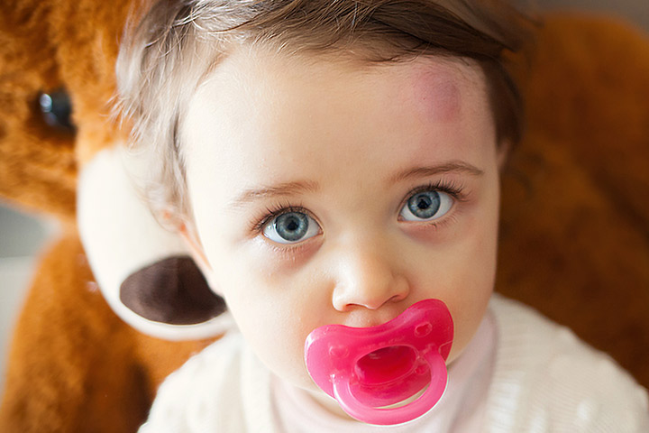 Que faire lorsque votre bébé est touché à la tête