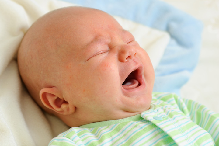 Syndrome de Marfan chez les bébés
