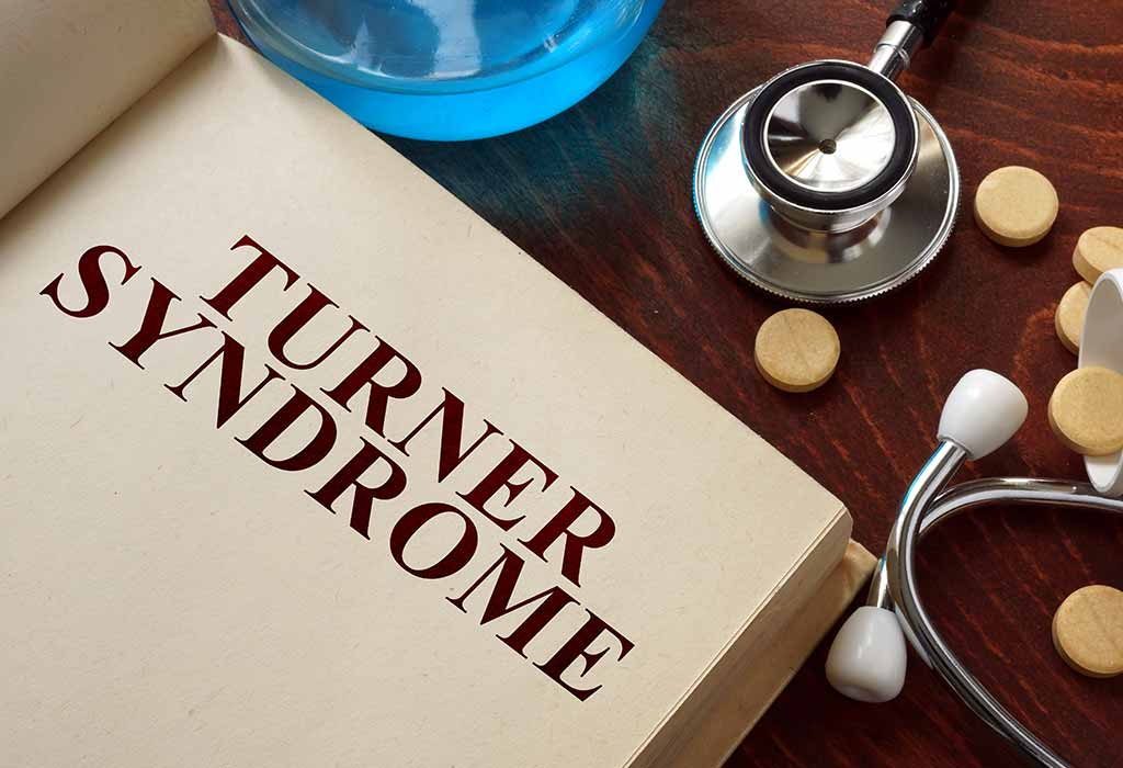 Syndrome de Turner - Symptômes, causes et traitement 7 SYNDROME DE TURNER