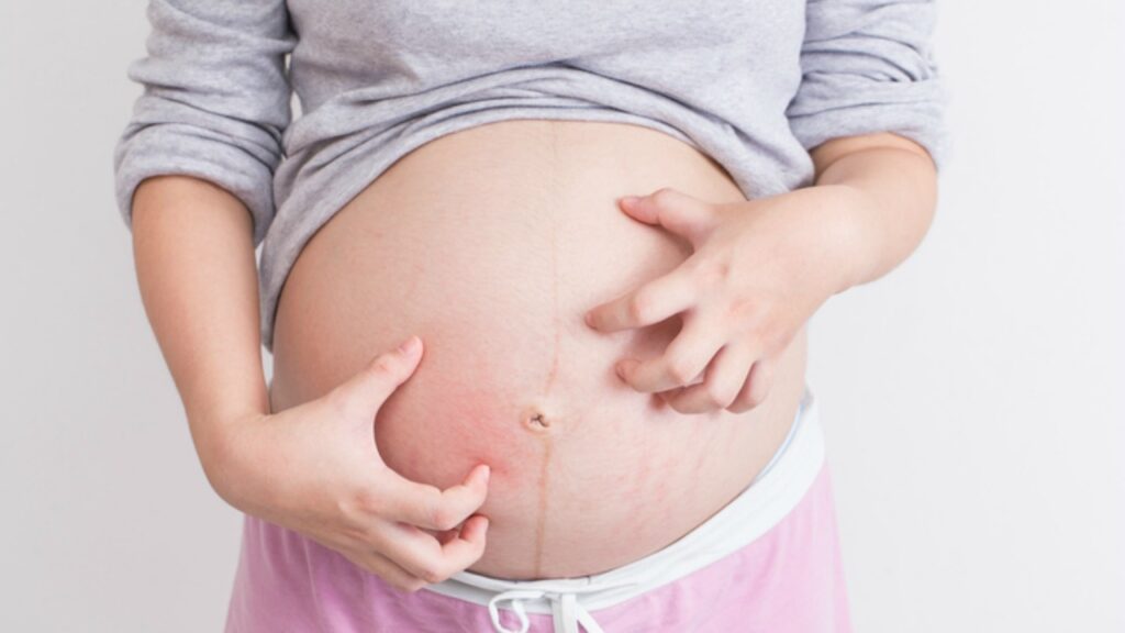 L'état de grossesse irritant, irritant et souvent dangereux que personne ne connaît