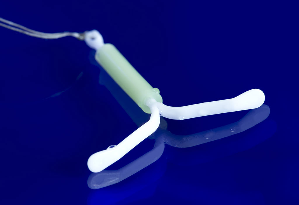 Tomber enceinte après le retrait du DIU: combien de temps cela prend-il? 7 Tomber enceinte après le retrait du DIU - Combien de temps faut-il?