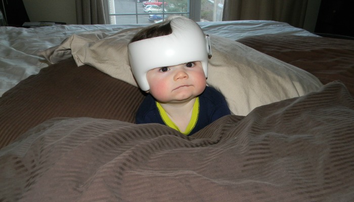 Votre bébé a donc besoin d'un casque? Ça ira, je le promets