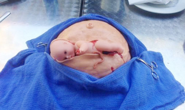 Souhaitez-vous un gâteau C-Section à votre douche de bébé?